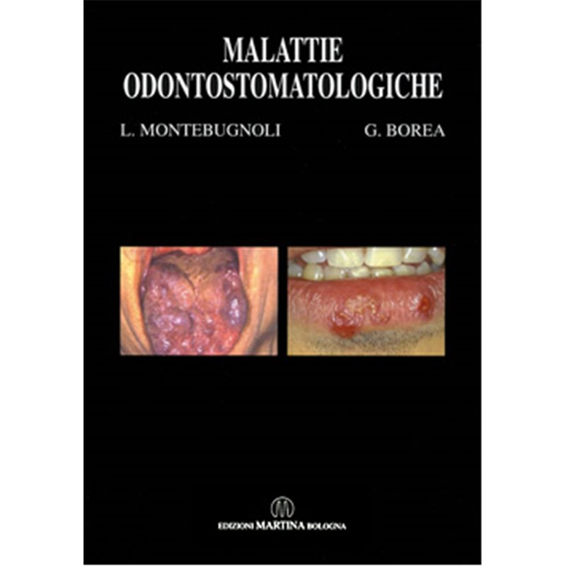 Malattie Odontostomatologiche